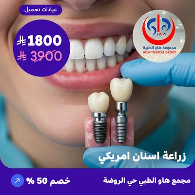 (American dental implants) At How Medical Center, Rawdah District
