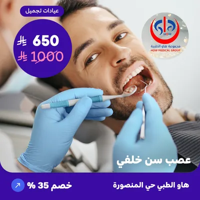 Posterior tooth nerve (At How Medical Center, Mansoura district)