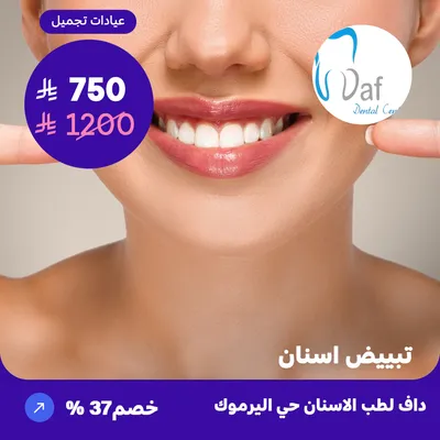 Teeth whitening (At DAF Dental, Yarmouk District)