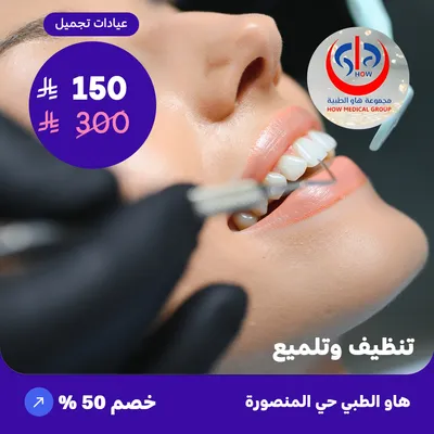 Teeth cleaning and polishing (At How Medical Center, Mansoura district)
