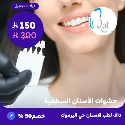 Superficial dental fillings (At DAF Dental, Yarmouk District)