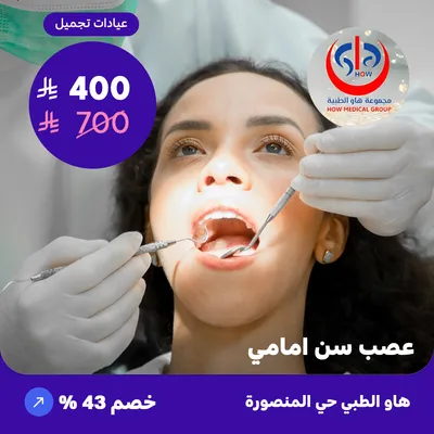 Anterior tooth nerve (At How Medical Center, Mansoura district)
