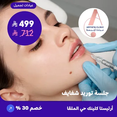 Lip augmentation session (At Artista Clinic, Al-Malqa District)