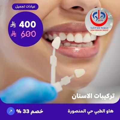 Dental implants (At How Medical Center, Mansoura district)