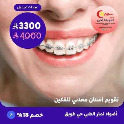 Metal braces for both jaws (At Adawa Namar, Tuwaiq neighborhood)